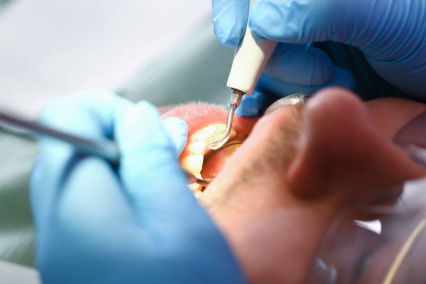 Best Urgent Tooth Repair  in Ashley, PA